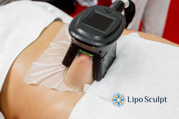 Does Fat Freezing at Home Work? DIY Devices vs Professional Cryolipolysis 1 How is professional cryolipolysis different Birchills?