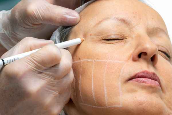 CryoPen: 5 Skin Concerns It May Be Used to Treat 4 What should you ask before having CryoPen treatment Birchills?